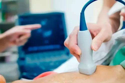 Exame de ecocardiograma